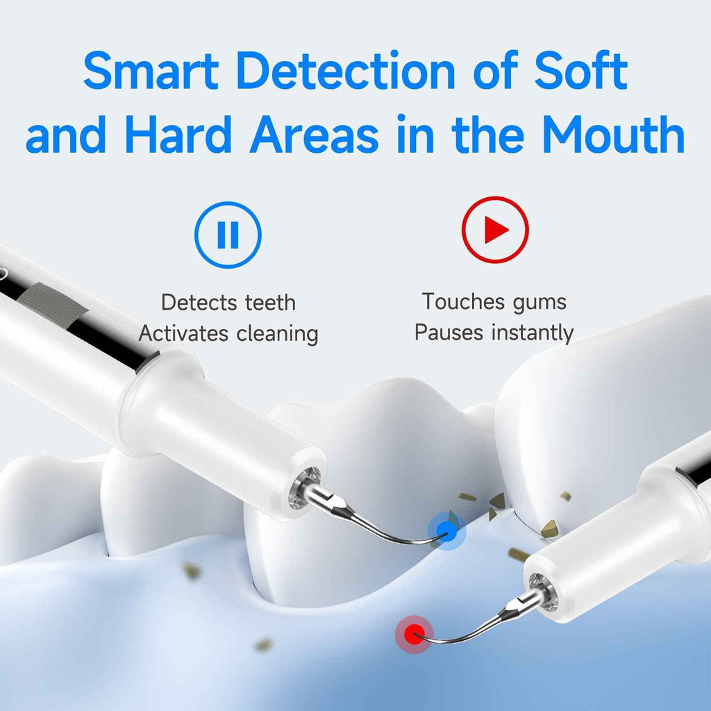 T7 Ultrasonic Tooth Cleaner | Advanced Plaque & Tartar Removal